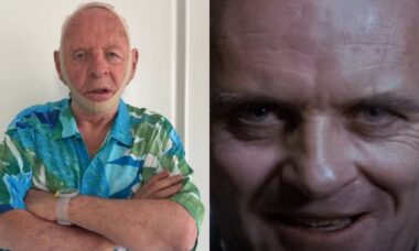 Anthony Hopkins viraliza após incorporar Hannibal Lecter ao experimentar faixa facial da SKIMS