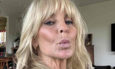 Ulrika Jonsson mostra antes e depois de tratamento de seis meses contra danos do sol na pele